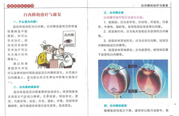 白内障最新疗法，重塑视界之光，引领视界重塑的希望之光