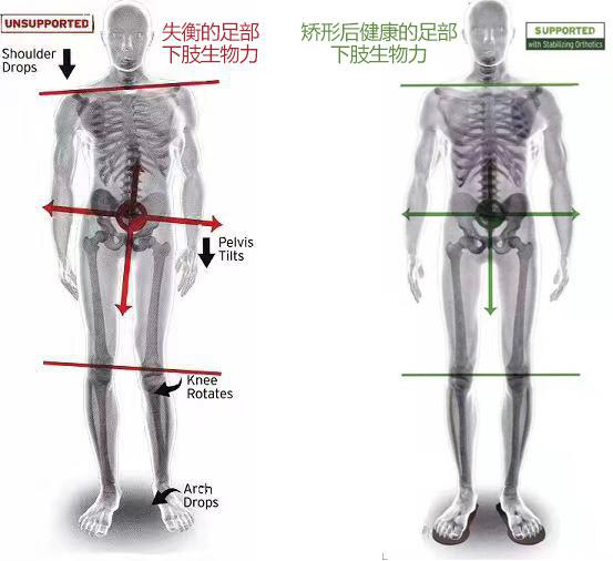 拇外翻在线咨询，一站式了解、诊断与治疗服务